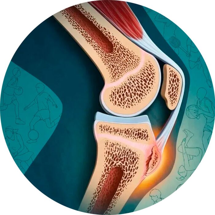 La structure de l'articulation et des tissus environnants.