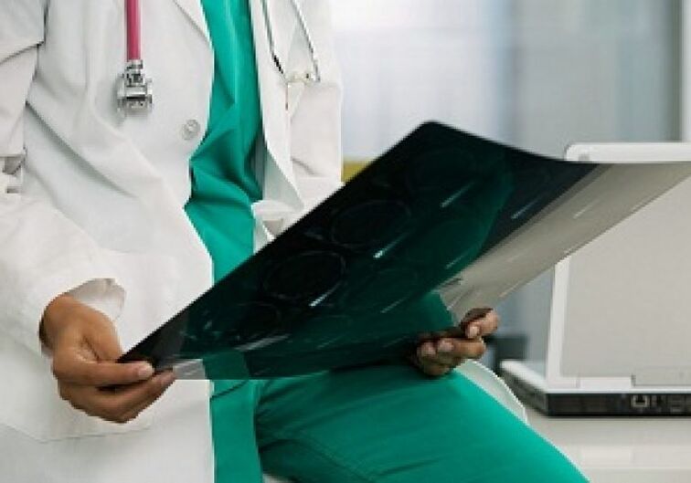 La radiographie aidera le médecin à diagnostiquer l'ostéochondrose de la colonne thoracique